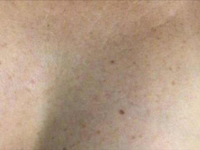 Capturi de ecran de difuzare Alianakiss